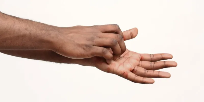 la-paume-paume-qui-demange-doit-on-sen-rejouir-ou-sen-inquieter-voici-les-reelles-causes