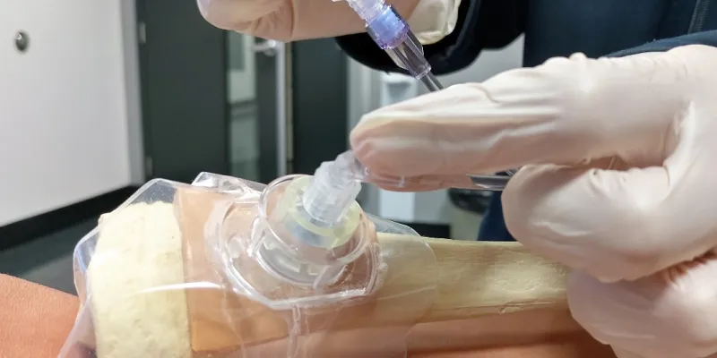 saviez-vous-que-les-perfusions-pouvaient-se-faire-par-voie-intra-osseuse