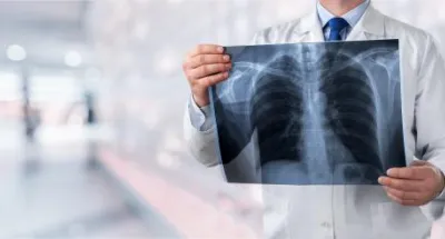 cancer-chez-lhomme-voici-comment-reduire-le-risque