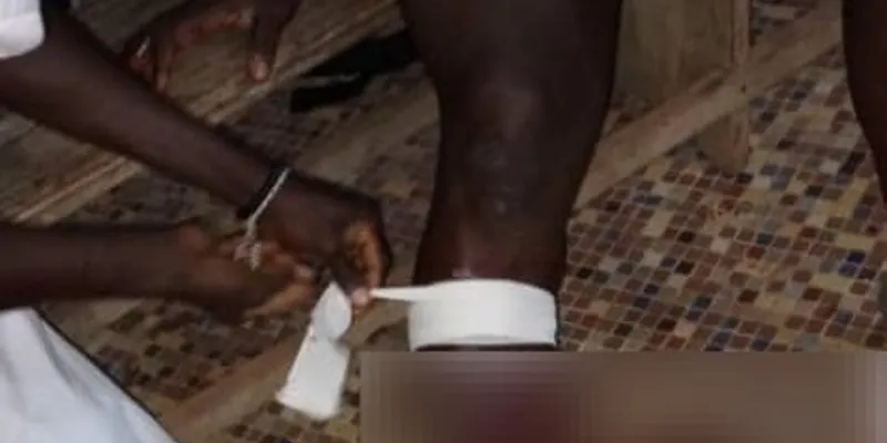 toulepleu-sahibly-un-gendarme-blesse-a-larme-a-feu-par-inadvertance