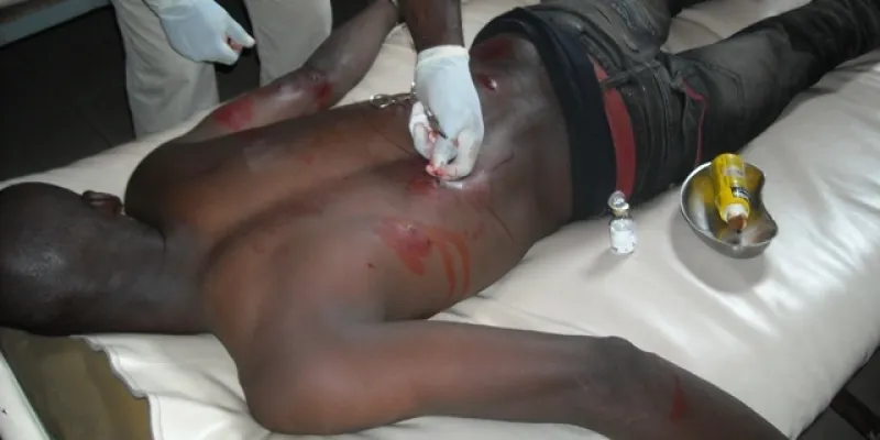 gohitafla-un-planteur-blesse-gravement-a-la-tete-avec-une-machette