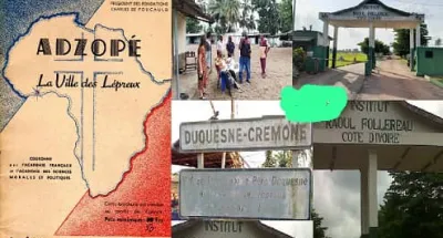 70eme-journee-mondiale-des-maladies-de-la-lepre-le-gouvernement-ivoirien-aux-cotes-des-malades